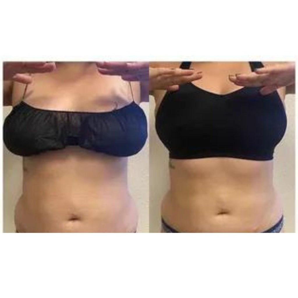 Dettaglio fascia larga DeepBra