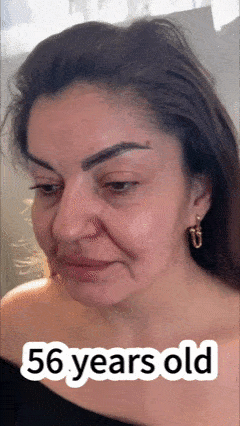 Applicazione Eslow Age sul viso