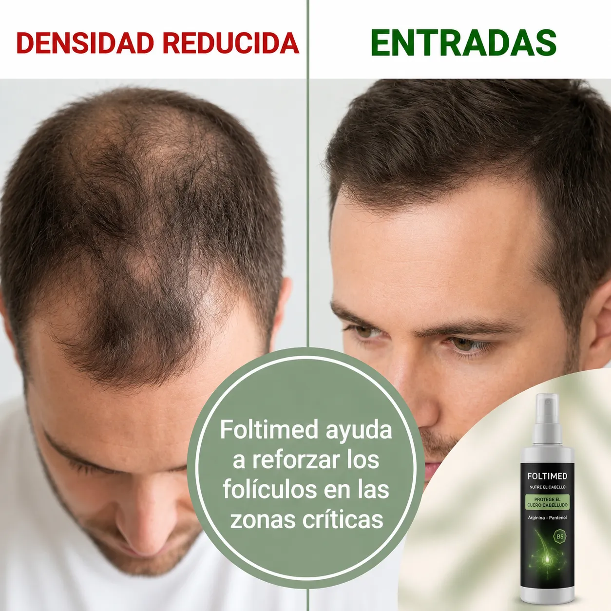 Hombre mir&aacute;ndose al espejo preocupado por su pelo