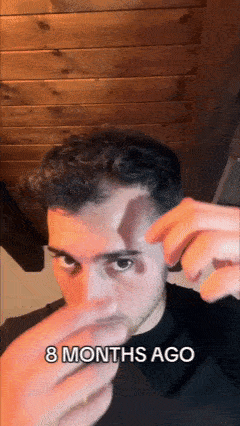 Aplicaci&oacute;n de Foltimed sobre el cuero cabelludo